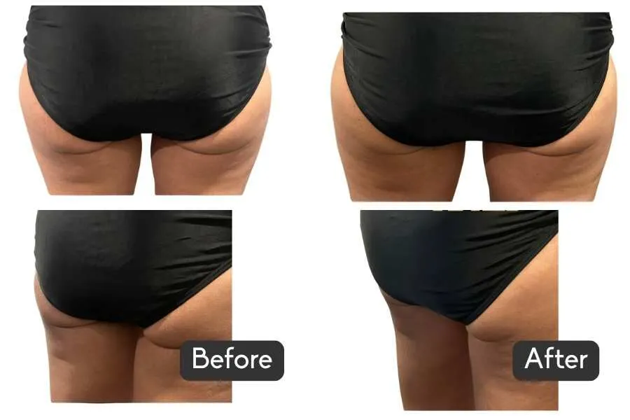 Body Scupting_affiliatemedicaland welnessanuFORM